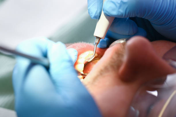 Best Emergency Treatment for Toothache in Mante, CA