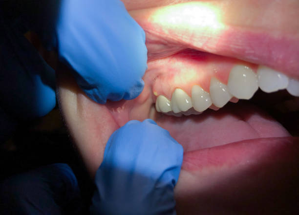 Best Walk-In Emergency Dentist in Mante, CA