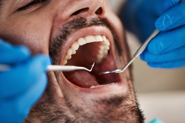 Best Emergency Treatment for Toothache in Mante, CA